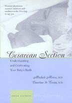 Cover image of Cesarean Section