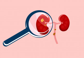 Thriving with Kidney Disease 2